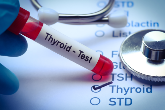 tiroidet