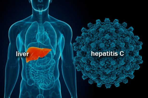 Hepatiti b